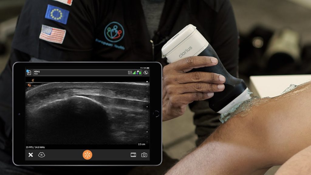 post_competition_knee