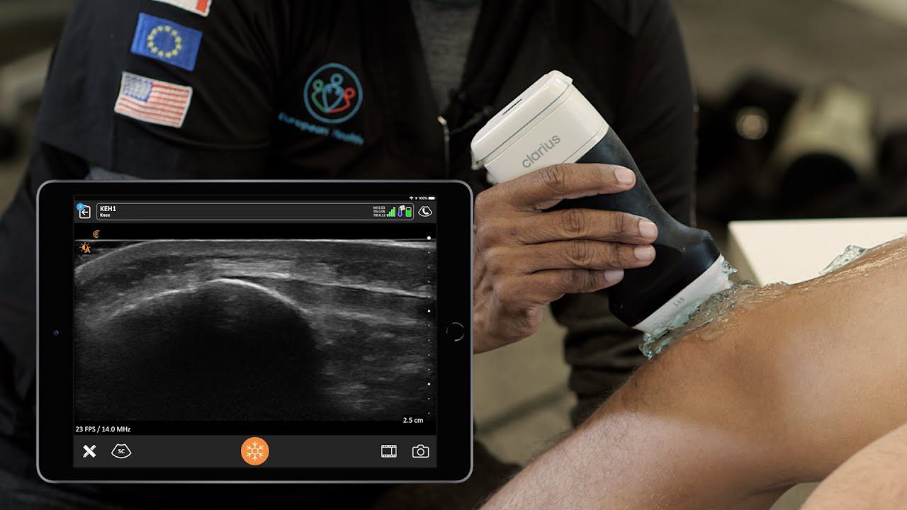 post_competition_knee