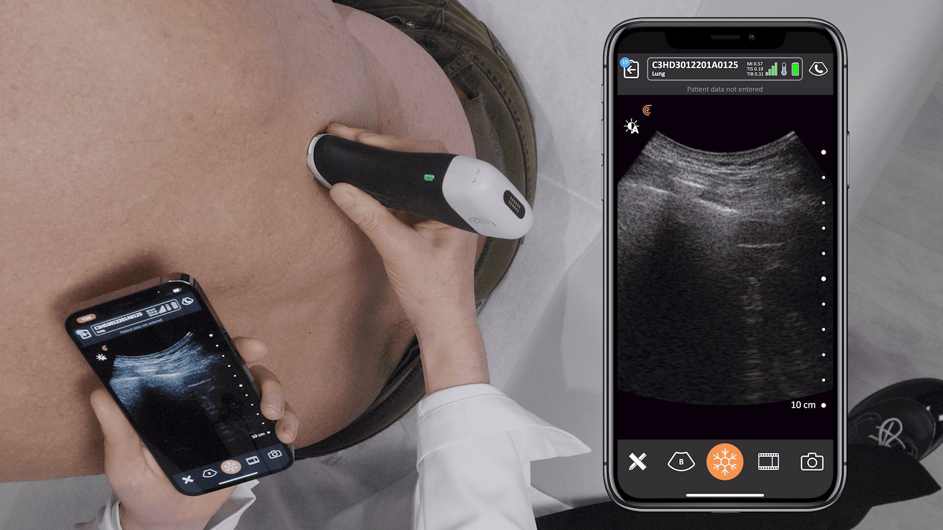 Lung Ultrasound | Clarius