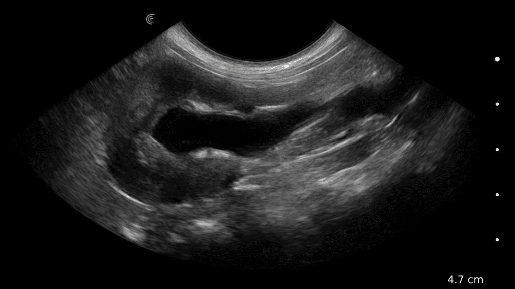 Canine Renal Obstruction
