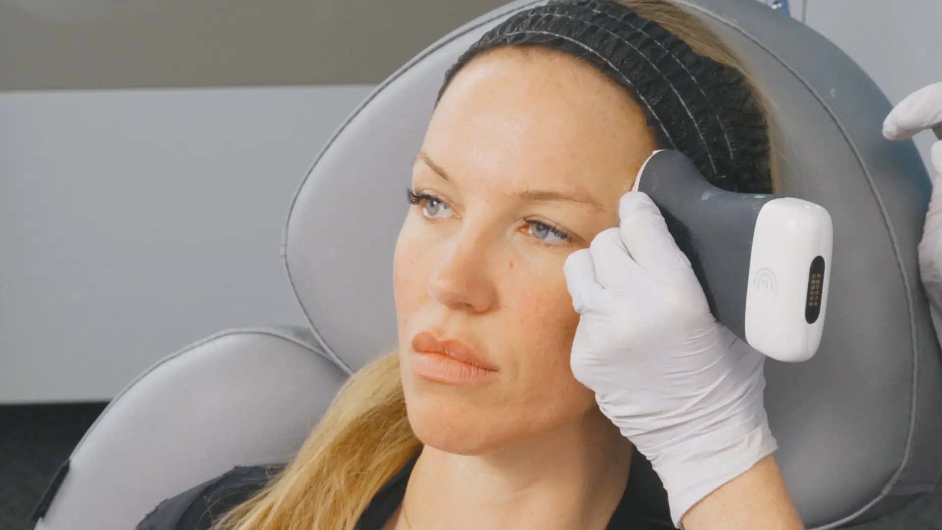 Facial Filler Safety 101: Ultrasound Mapping for Accurate Aesthetic ...