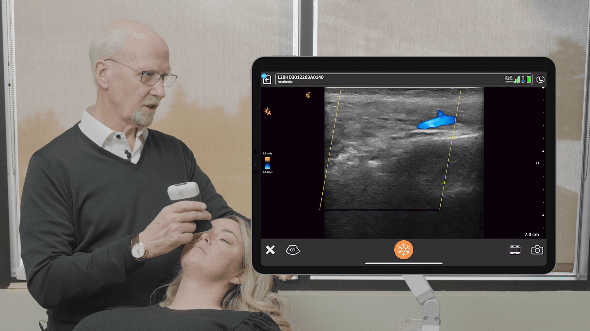 Ultrasound of the Tear Trough | Clarius