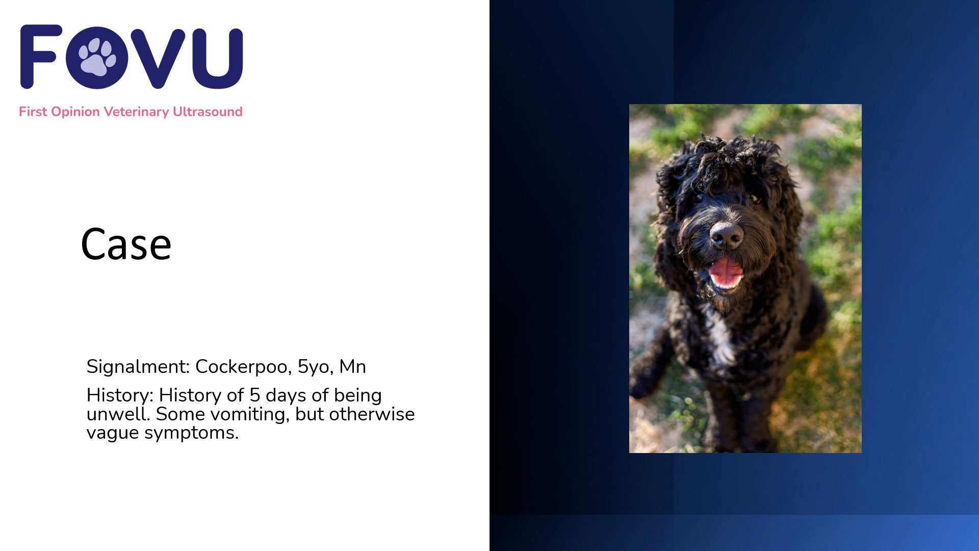 Heart Block with Severe Bradycardia Clarius