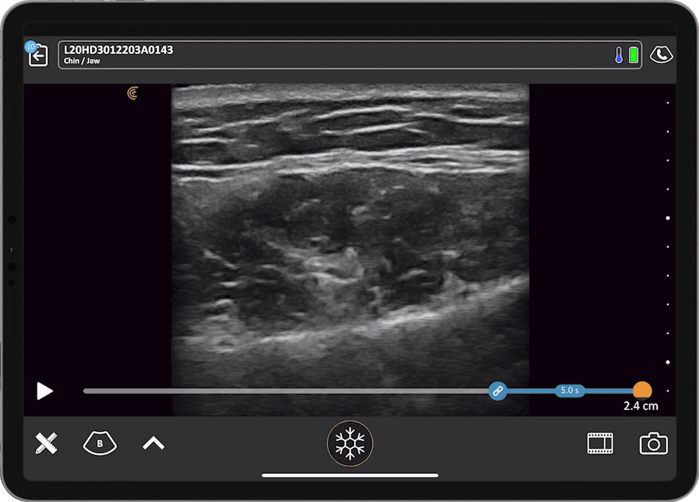 Ultrasound for Safe Jawline Rejuvenation: Visualizing Anatomy, Guiding ...