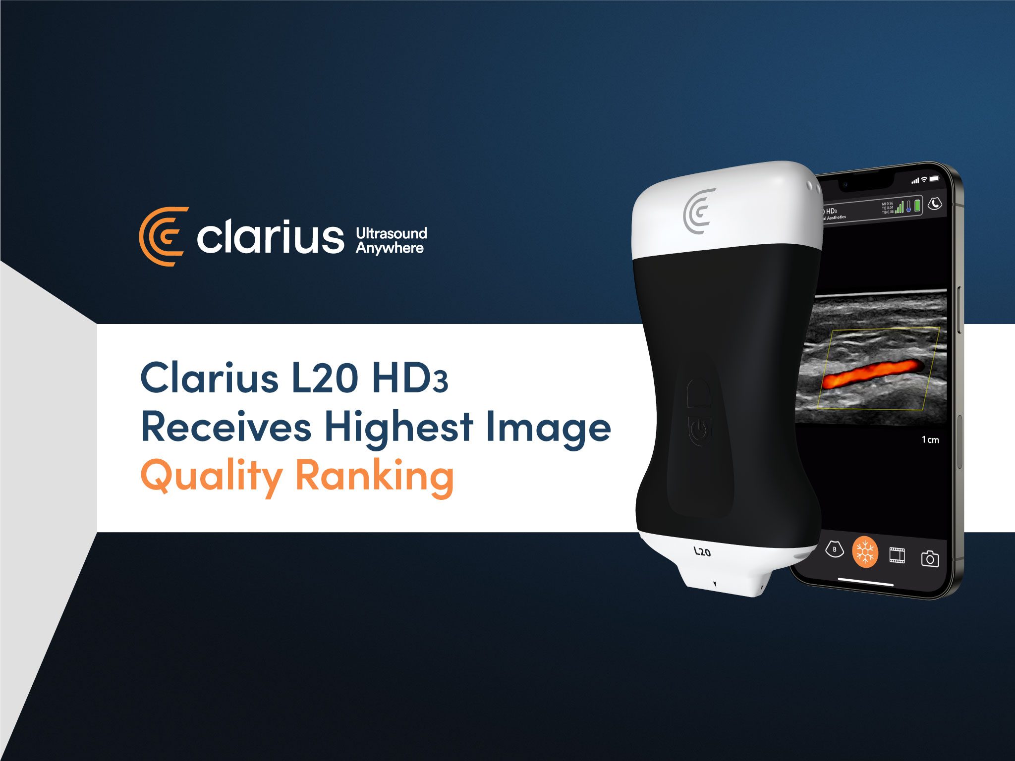 Clarius L20 Hd3 Receives Highest Image Quality Ranking Among Five Point Of Care Ultrasound 7678