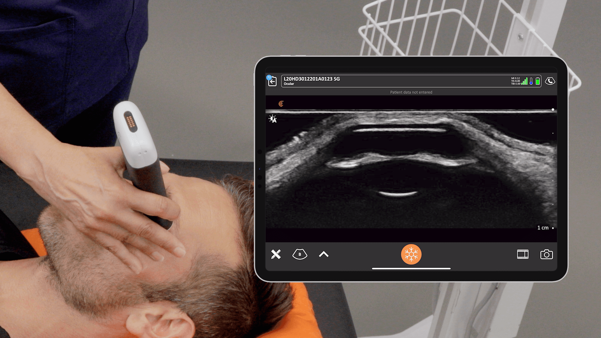 Ophthalmic Ultrasound | Clarius