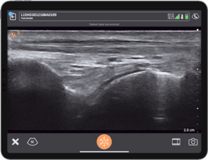 POCUS Essentials in Podiatry: Enhancing Foot and Ankle Assessments ...