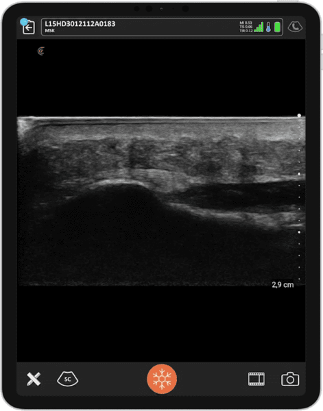 POCUS Essentials in Podiatry: Enhancing Foot and Ankle Assessments ...