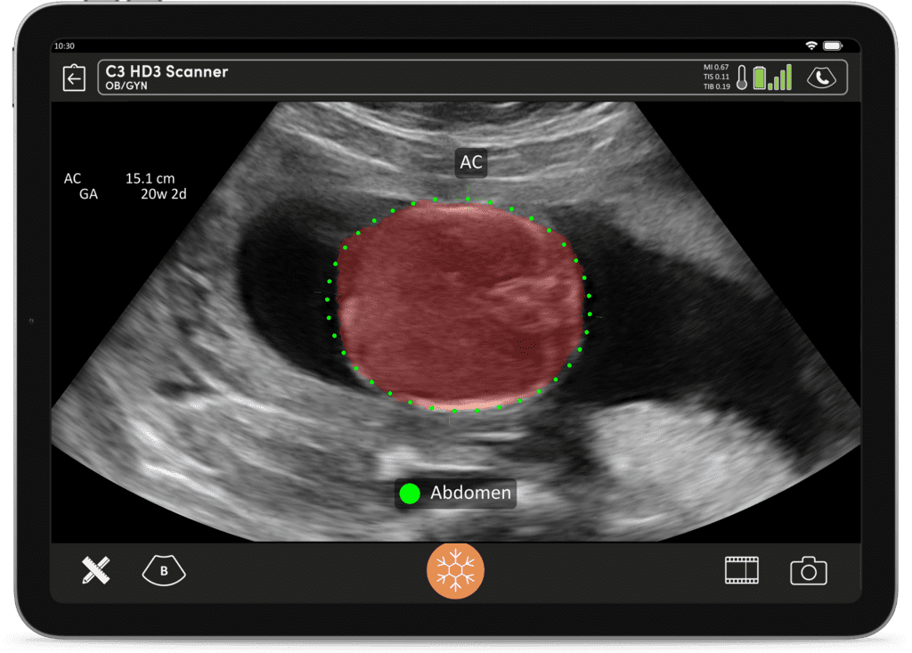 Clarius | Portable Pocket Handheld Ultrasound Scanners