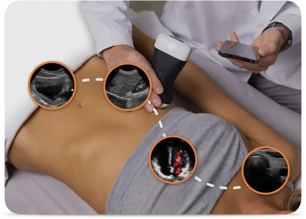 Point-of-care ultrasound (POCUS) is more accessible than ever with advanced wireless technology.