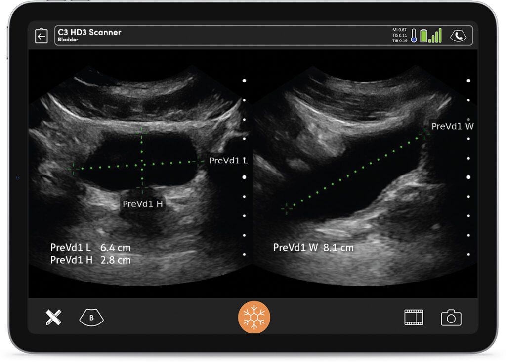 Wireless ultrasound eliminates the clutter of cables and enhances mobility for practitioners.