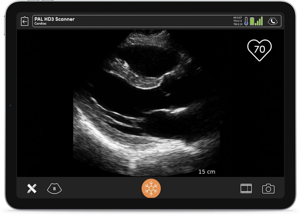 From emergency medicine to sports clinics, the Clarius HD3 is a trusted POCUS tool worldwide.