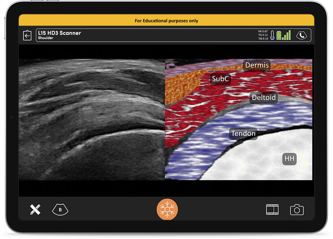 The Clarius HD3 delivers high-resolution imaging in a compact, easy-to-use design.