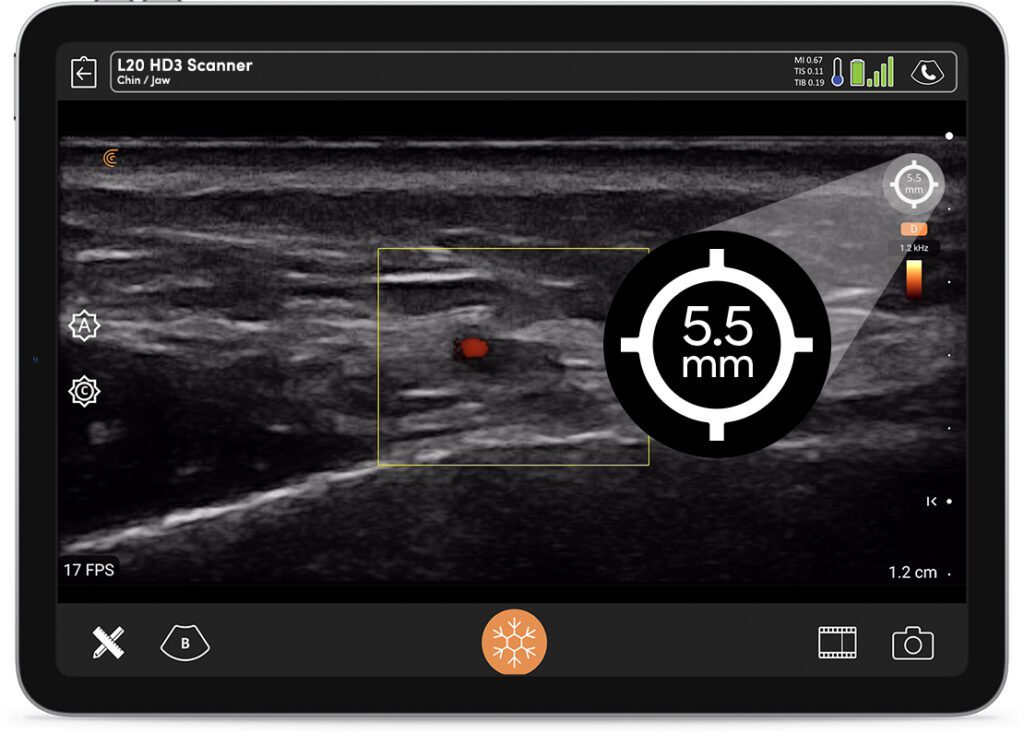 This handheld ultrasound is revolutionizing how healthcare professionals deliver care in remote locations.