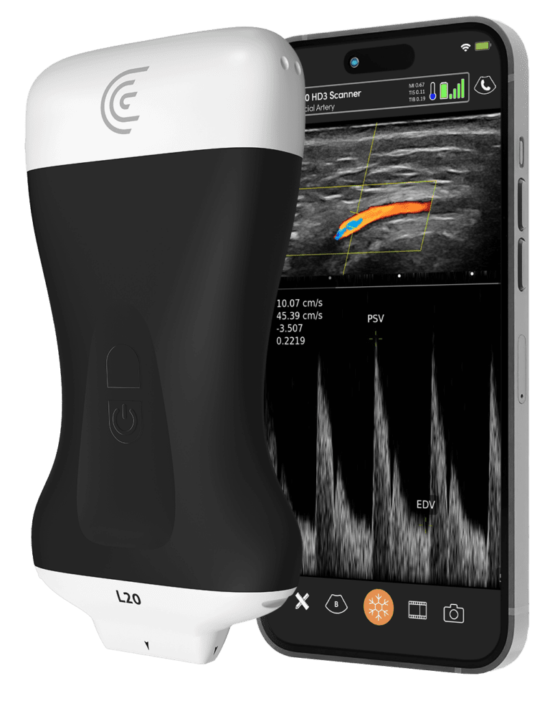 Portable Ultrasound