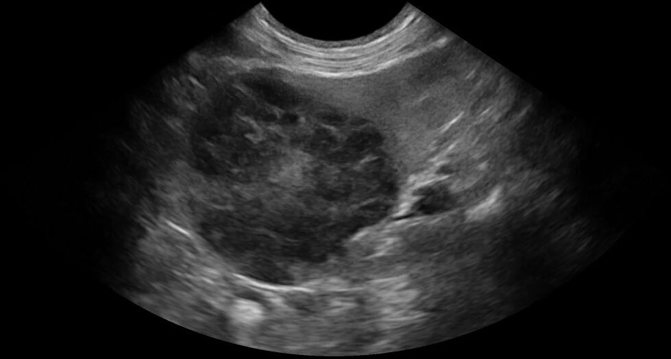 Ultrasound image of a canine splenic mass suggestive of lymphoma, captured in a veterinary abdominal scan.