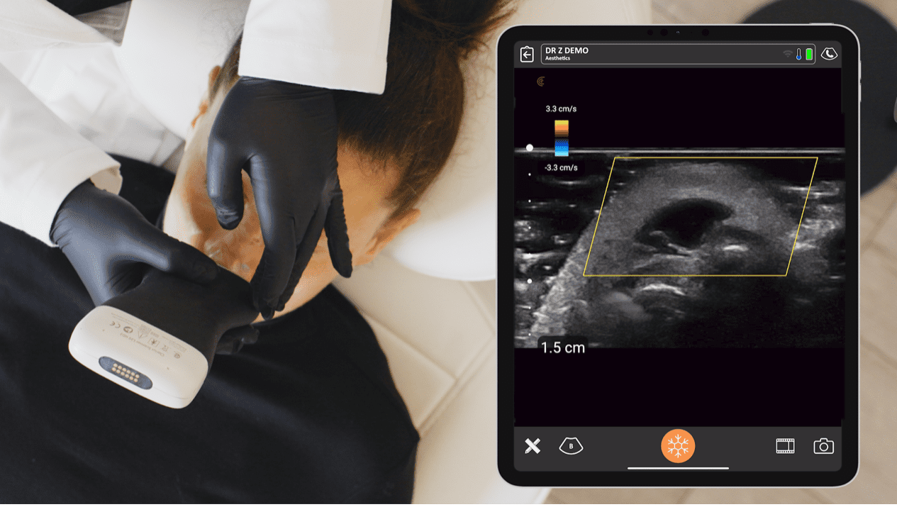 Ultrasound image highlighting high-risk facial anatomy including major vessels and nerves for aesthetic procedures.