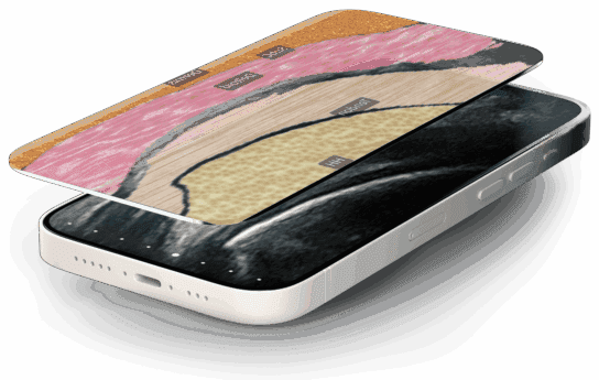 Clarius Intelligence